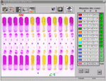 Classification de culture de bactéries par chromatographie