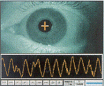 Tracking of eye motion